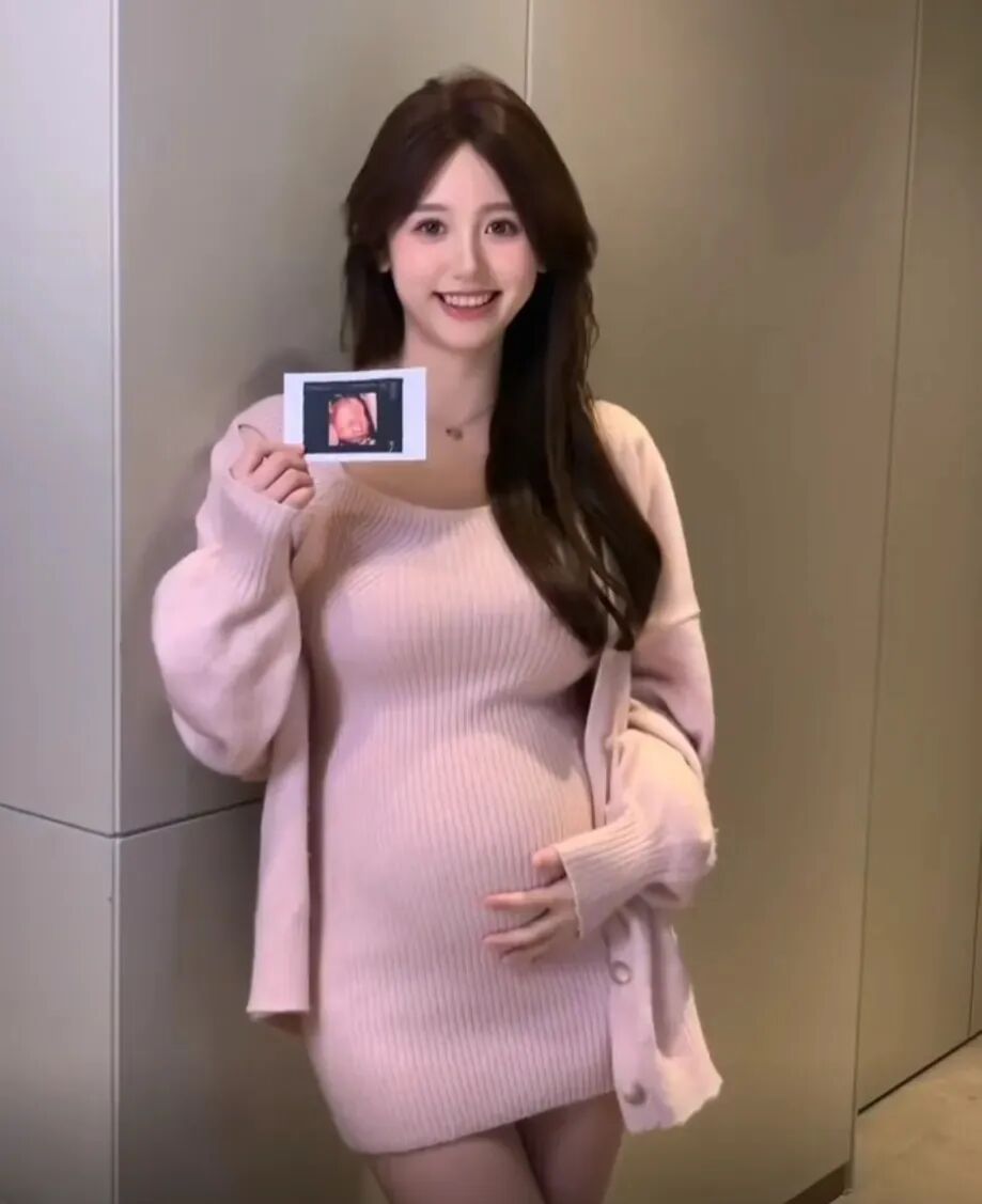 _孕妇眼球充血怎么办_孕期眼球突出怎么回事