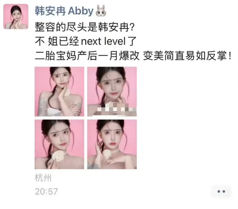 韩安冉产后一月就整容，大方晒出打针后的照片，整个脸都变形了_韩安冉产后一月就整容，大方晒出打针后的照片，整个脸都变形了_