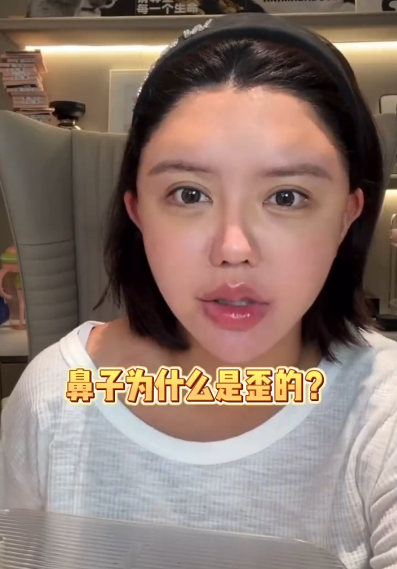 韩安冉产后一月就整容，大方晒出打针后的照片，整个脸都变形了_韩安冉产后一月就整容，大方晒出打针后的照片，整个脸都变形了_