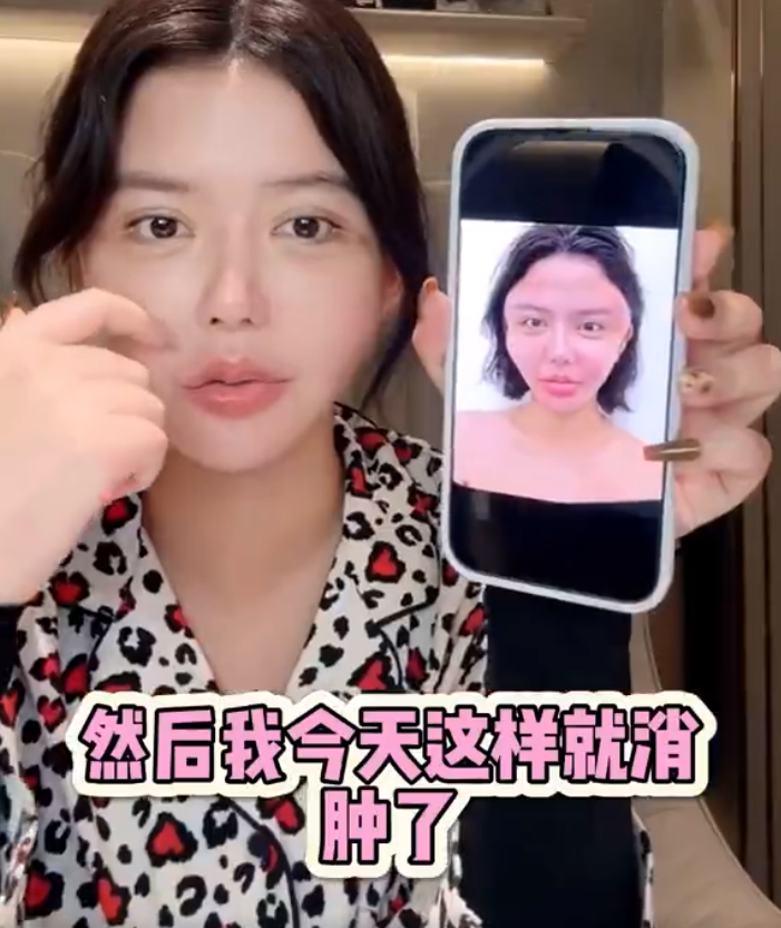 韩安冉产后一月就整容，大方晒出打针后的照片，整个脸都变形了__韩安冉产后一月就整容，大方晒出打针后的照片，整个脸都变形了