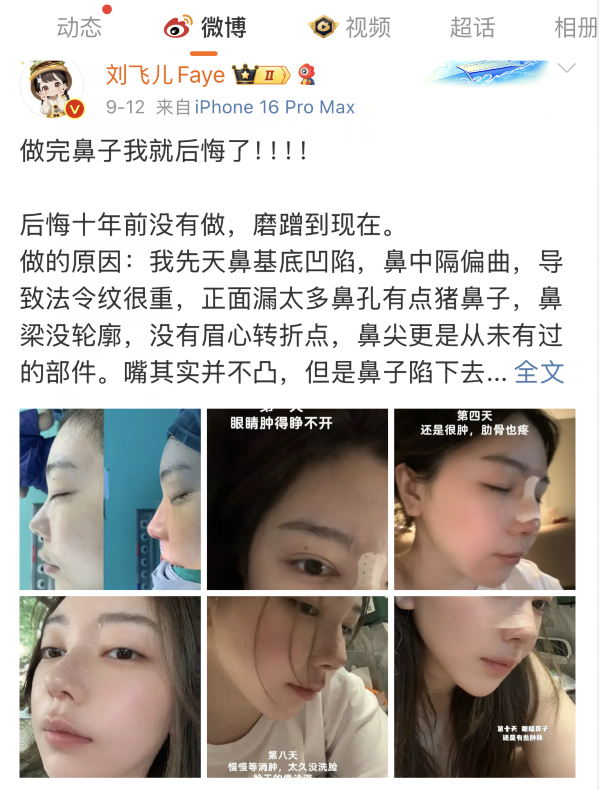 _整鼻子毁容_整容鼻子知乎