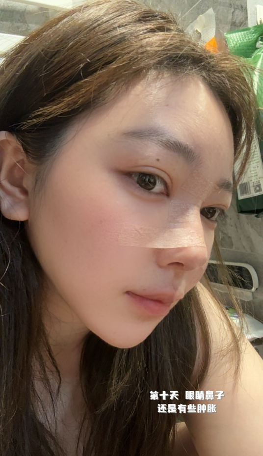 整鼻子毁容__整容鼻子知乎