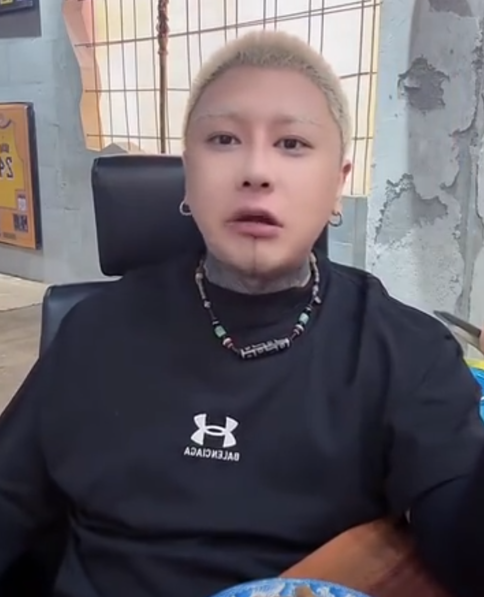 瘦成排骨的吓人图片__谢娜曝维嘉暴瘦原因