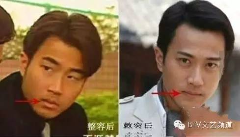 娱乐圈疑似整容男星_男星整容前后对比_汪东城到底整没整容