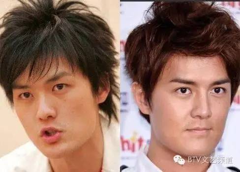 男星整容前后对比_娱乐圈疑似整容男星_汪东城到底整没整容