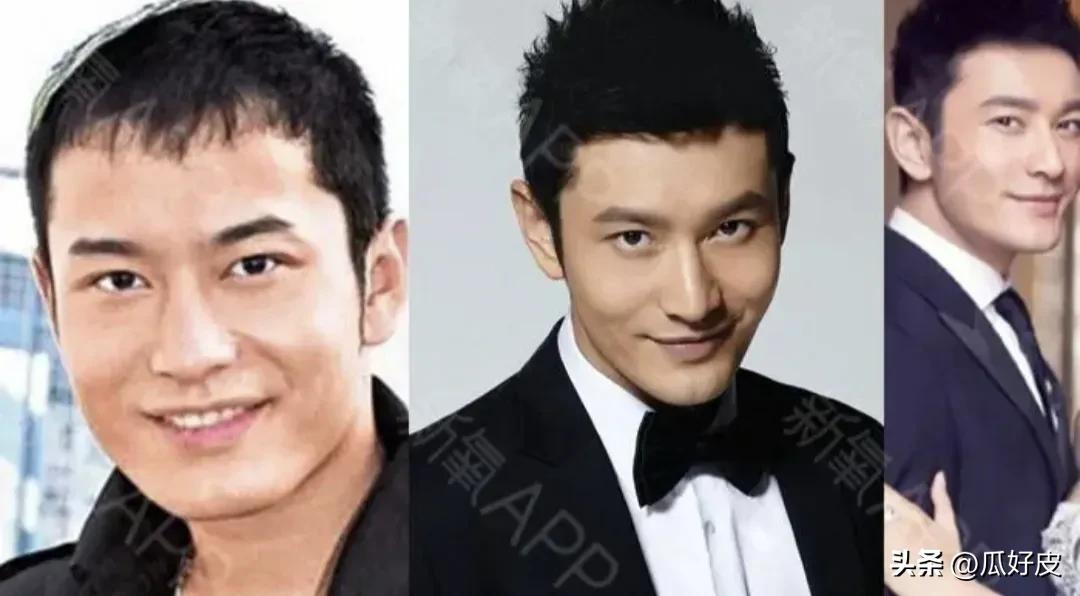 微整形男明星_汪东城到底整没整容_整容明星排行