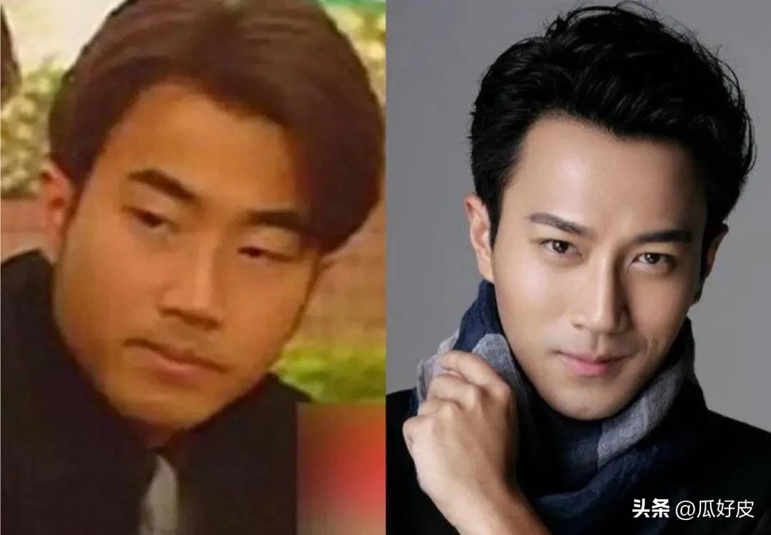 微整形男明星_整容明星排行_汪东城到底整没整容