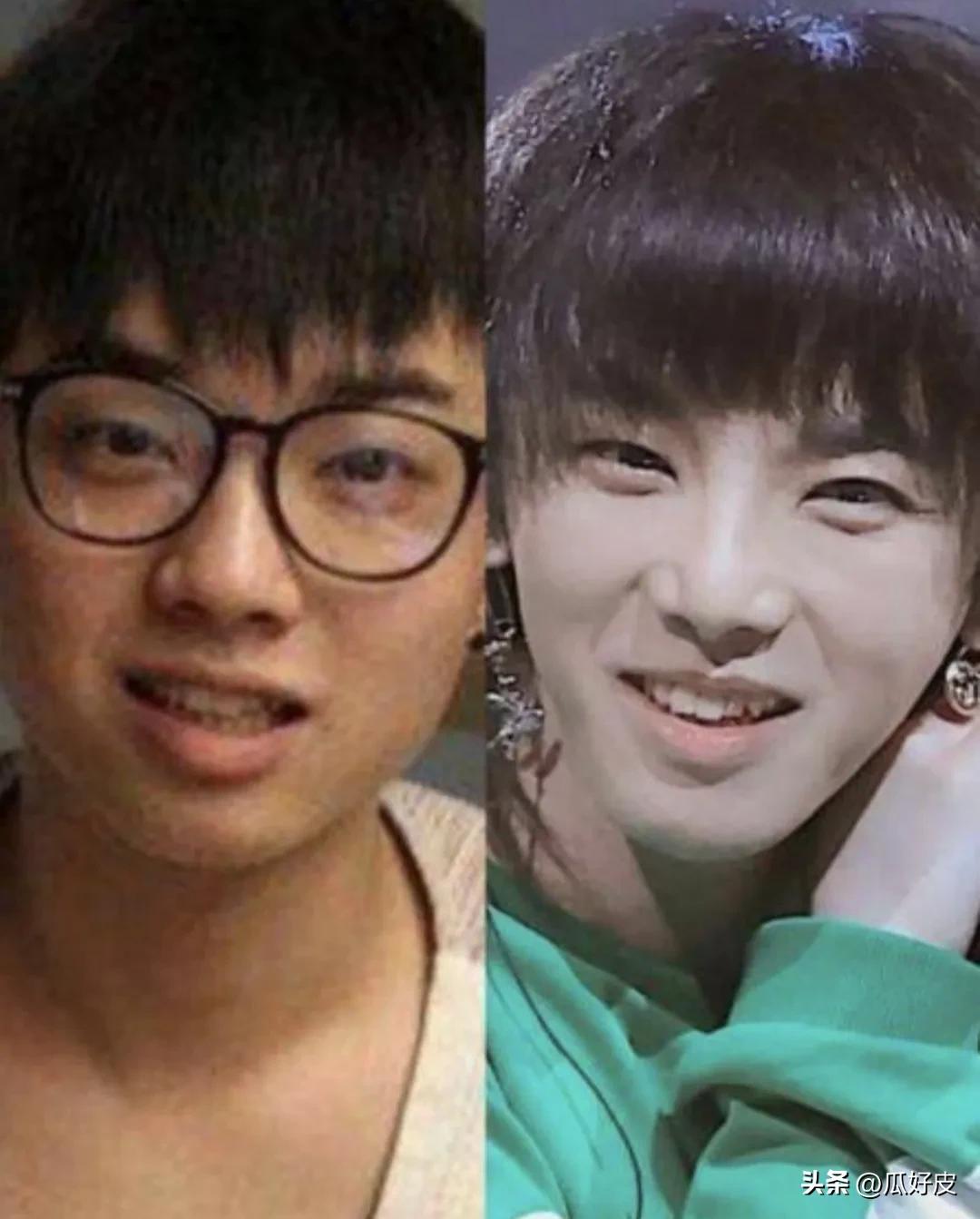 整容明星排行_汪东城到底整没整容_微整形男明星