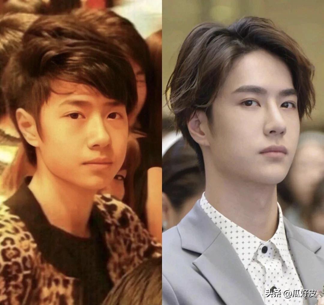 微整形男明星_汪东城到底整没整容_整容明星排行