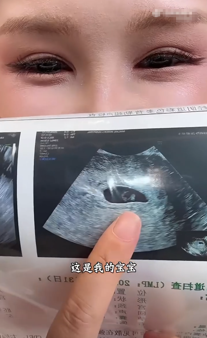 何婧婧自曝怀孕八周,刘一手发歌《爱你太多》,董莹莹回应“从此再无交集”?(图3)
